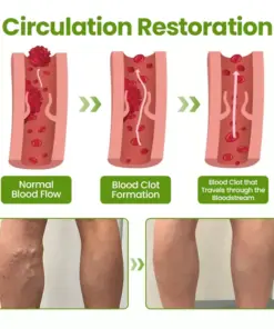 Timilk®VeinEase Leg Mask