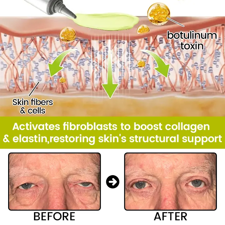 Timilk® Botox Retinol Shot Smoother-Looking Skin for Deep Lines, Sagging Jowls Puffy Eyes