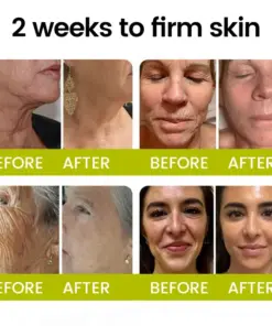 Timilk® Botox Retinol Shot Smoother-Looking Skin for Deep Lines, Sagging Jowls Puffy Eyes