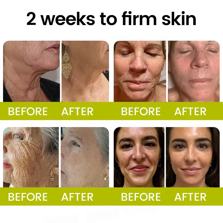 Timilk® Botox Retinol Shot Smoother-Looking Skin for Deep Lines, Sagging Jowls Puffy Eyes