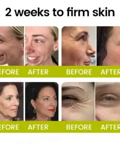 Timilk® Botox Retinol Shot Smoother-Looking Skin for Deep Lines, Sagging Jowls Puffy Eyes
