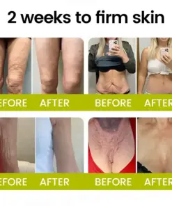 Timilk® Botox Retinol Shot Smoother-Looking Skin for Deep Lines, Sagging Jowls Puffy Eyes