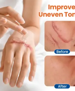 Timilk® DermalRebuild Skin Renewal Gel