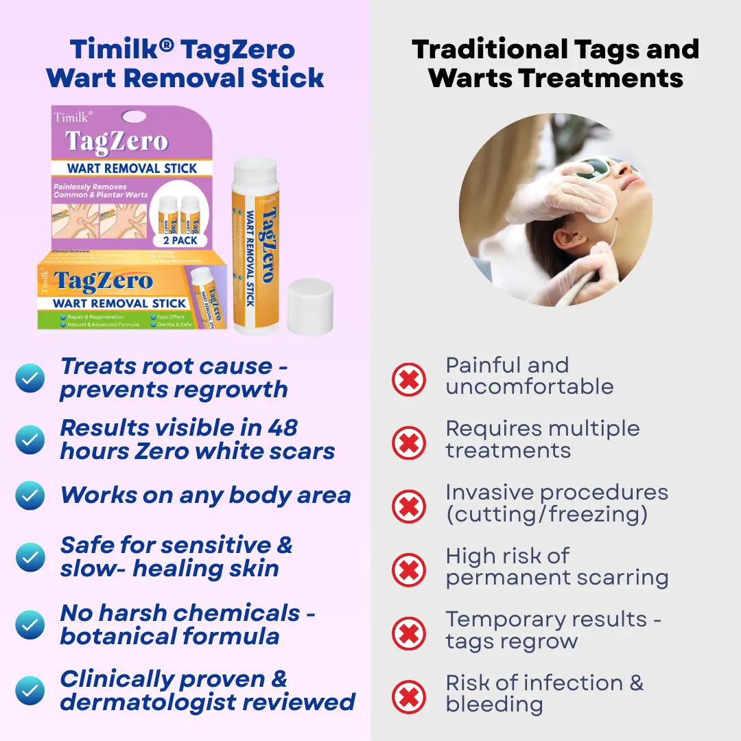 Timilk® TagZero Wart Removal Stick