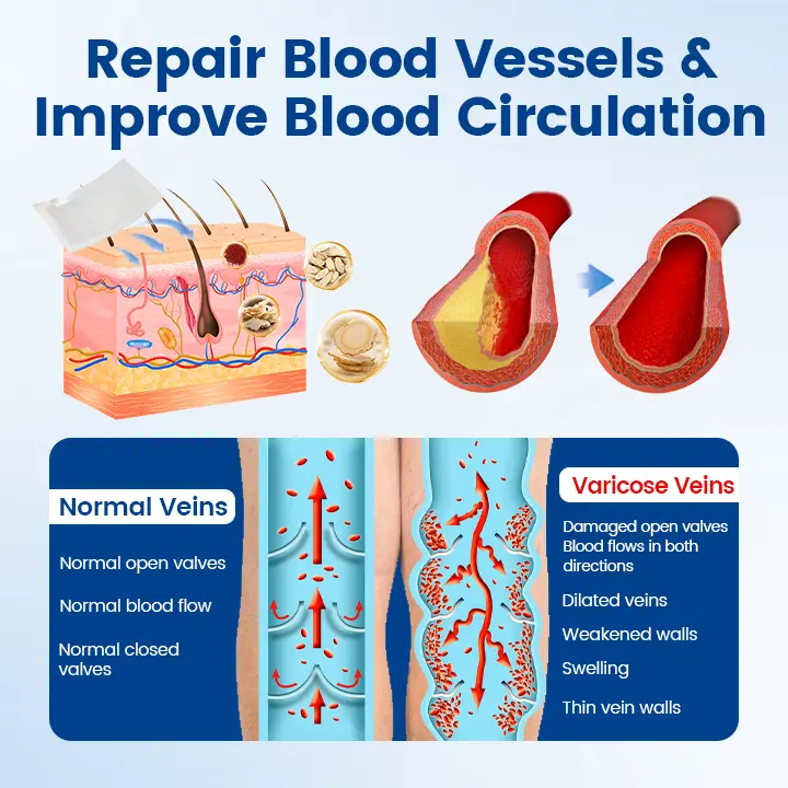 Timilk® Vein Ease Microneedle Therapy Patch – Fast Effective and Non-Invasive Treatment for Varicose Veins Leg Swelling