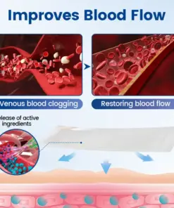 Timilk® Vein Ease Microneedle Therapy Patch – Fast Effective and Non-Invasive Treatment for Varicose Veins Leg Swelling