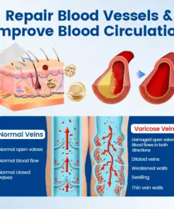 Timilk® Vein Ease Microneedle Therapy Patch - Fast ⚡Effective 💪 and Non-Invasive 🚫 Treatment for Varicose Veins & Leg Swelling 👣