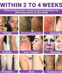 Timilk® Biotin 10-in-1 Skin Restoration Cream