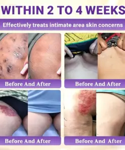 Timilk® Biotin 10-in-1 Skin Restoration Cream