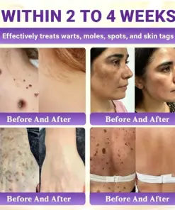 Timilk® Biotin 10-in-1 Skin Restoration Cream