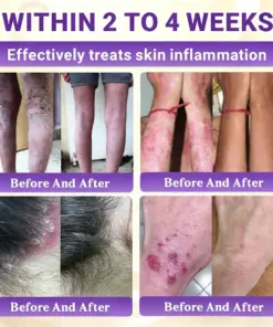 Timilk® Biotin 10-in-1 Skin Restoration Cream