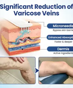 Timilk® Deep Vein Repair Microneedle Patch