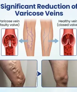 Timilk® Deep Vein Repair Microneedle Patch