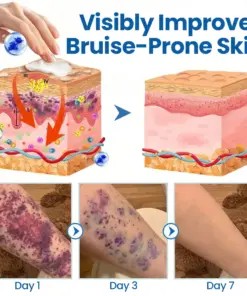 Timilk® Fragile Skin Repair Cream