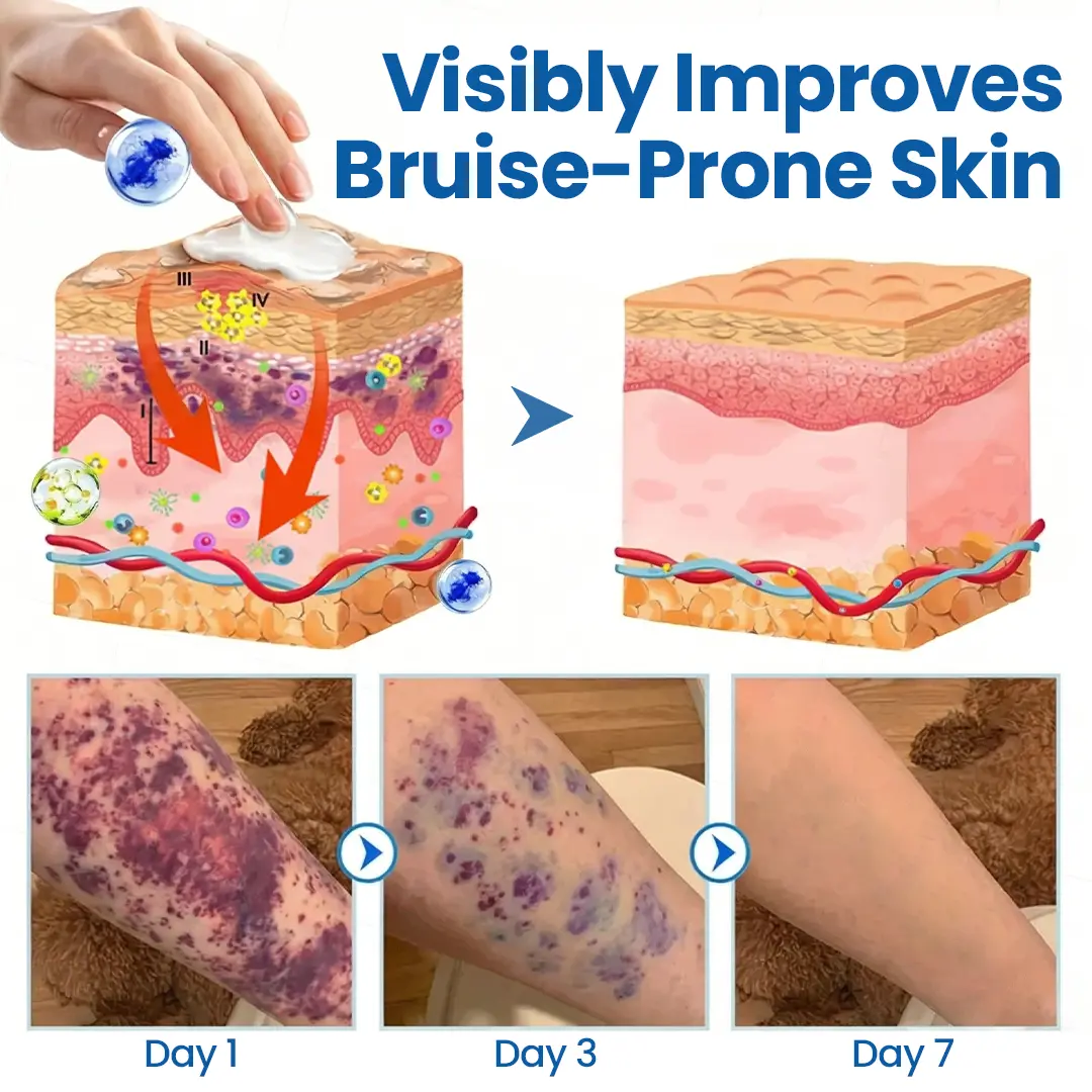 Timilk® Fragile Skin Repair Cream