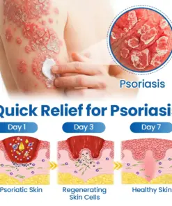 Timilk® Fragile Skin Repair Cream