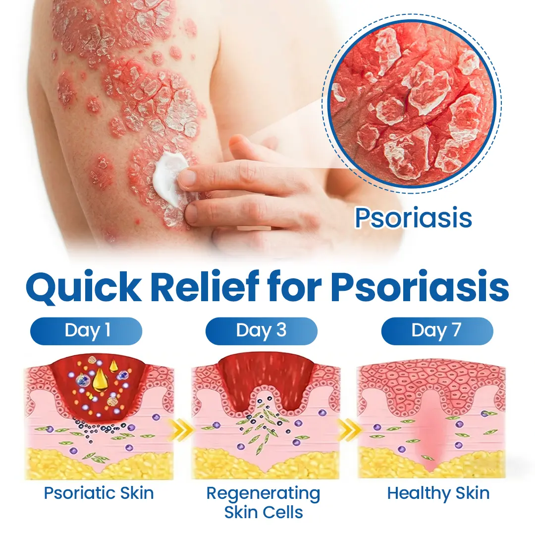 Timilk® Fragile Skin Repair Cream