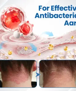 Timilk® Fragile Skin Repair Cream