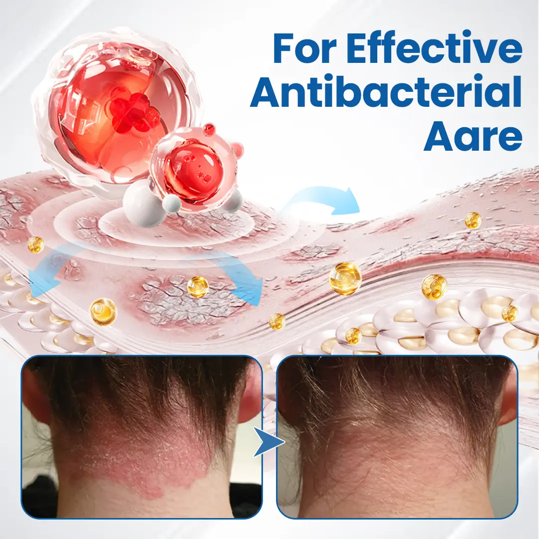 Timilk® Fragile Skin Repair Cream