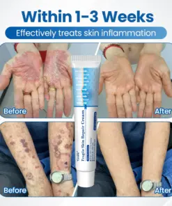 Timilk® Fragile Skin Repair Cream