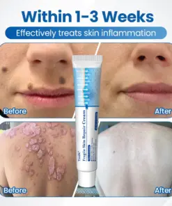 Timilk® Fragile Skin Repair Cream