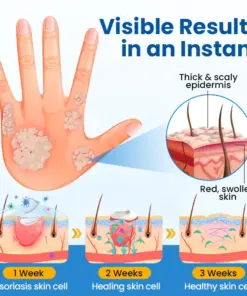 Timilk® Fragile Skin Repair Cream