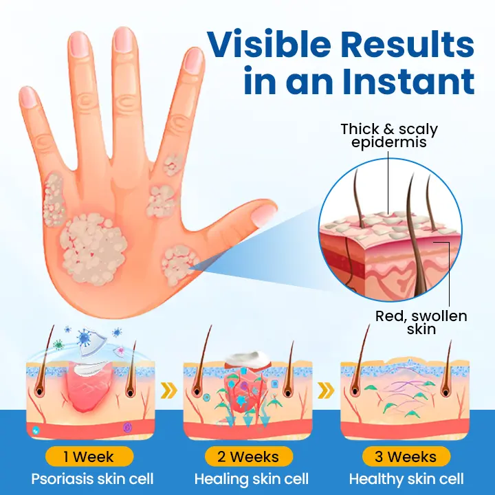 Timilk® Fragile Skin Repair Cream