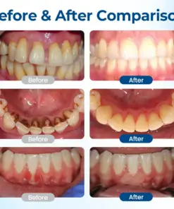 Timilk® GumHoney Oral Repair Drops