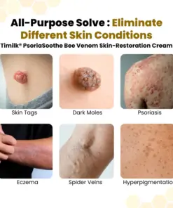 Timilk® PsoriaSoothe Bee Venom Skin-Restoration Cream
