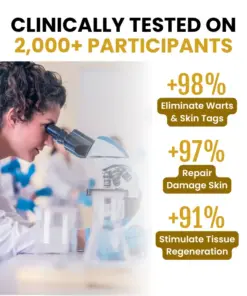 Timilk® PsoriaSoothe Bee Venom Skin-Restoration Cream