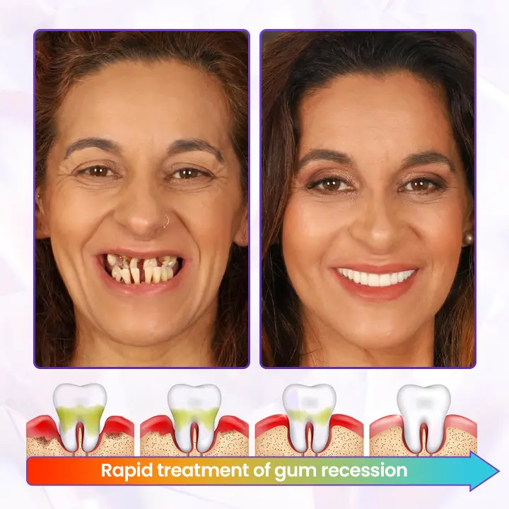 Timilk® BeeRenew Advanced Gum Healing Toothpaste