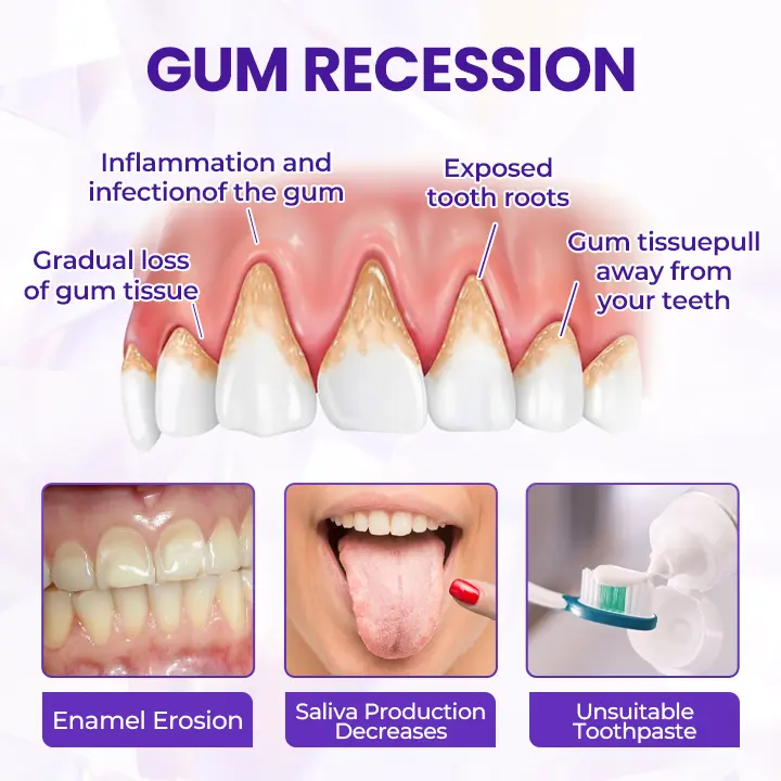 Timilk® BeeRenew Advanced Gum Healing Toothpaste