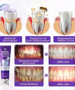 Timilk® BeeRenew Advanced Gum Healing Toothpaste