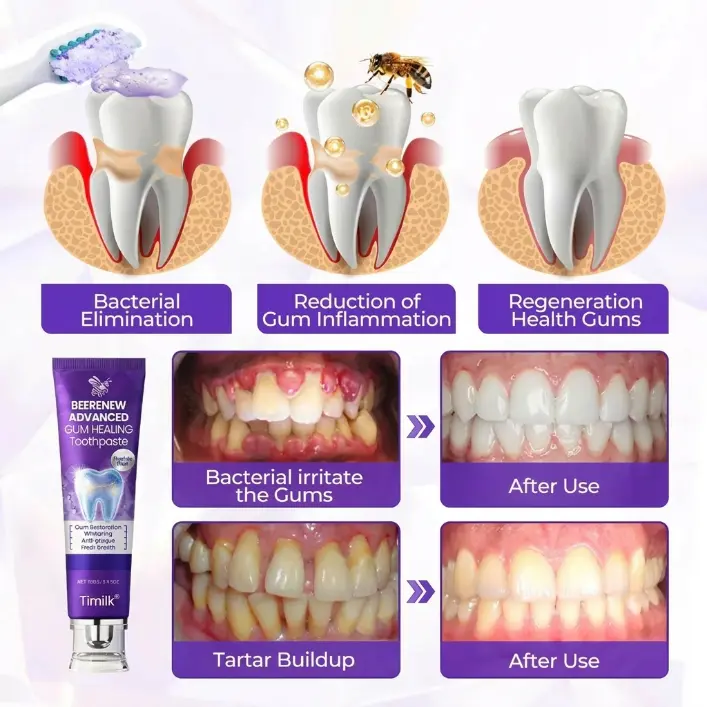 Timilk® BeeRenew Advanced Gum Healing Toothpaste