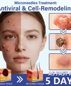 Timilk® DermalRepair 2-in-1 Microneedle & Hydrocolloid Patch