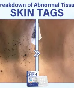 Timilk® DermalRepair 2-in-1 Microneedle & Hydrocolloid Patch