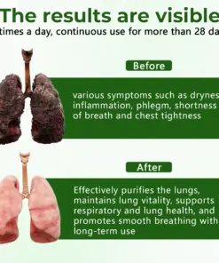 Timilk® 6-in-1 Herbal mullein Lung Cleanse Spray