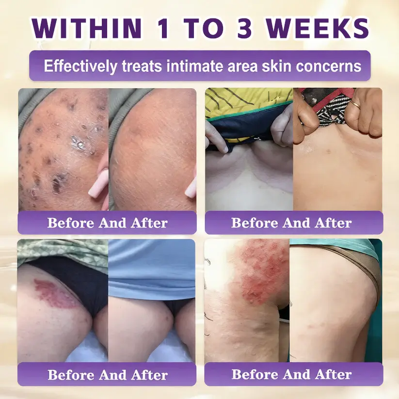 Timilk® Biotin 10-in-1 Skin Restoration Cream
