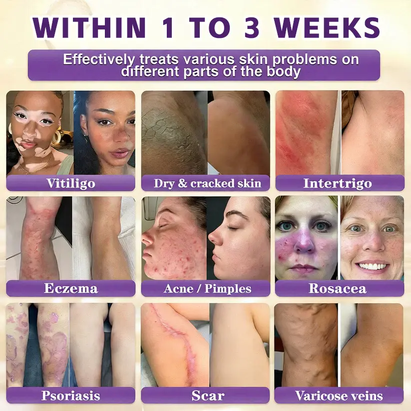 Timilk® Biotin 10-in-1 Skin Restoration Cream