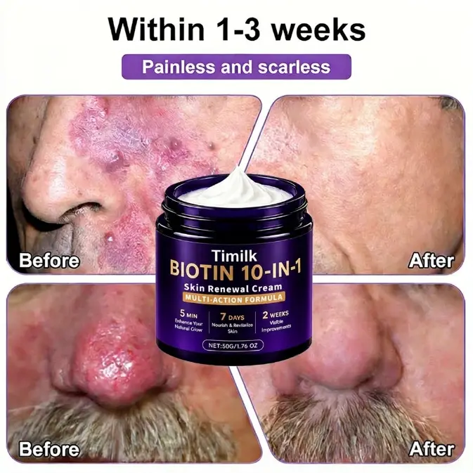 Timilk® Biotin 10-in-1 Skin Restoration Cream