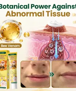 Timilk® Wart Remover Cream