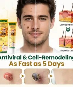 Timilk® Wart Remover Cream