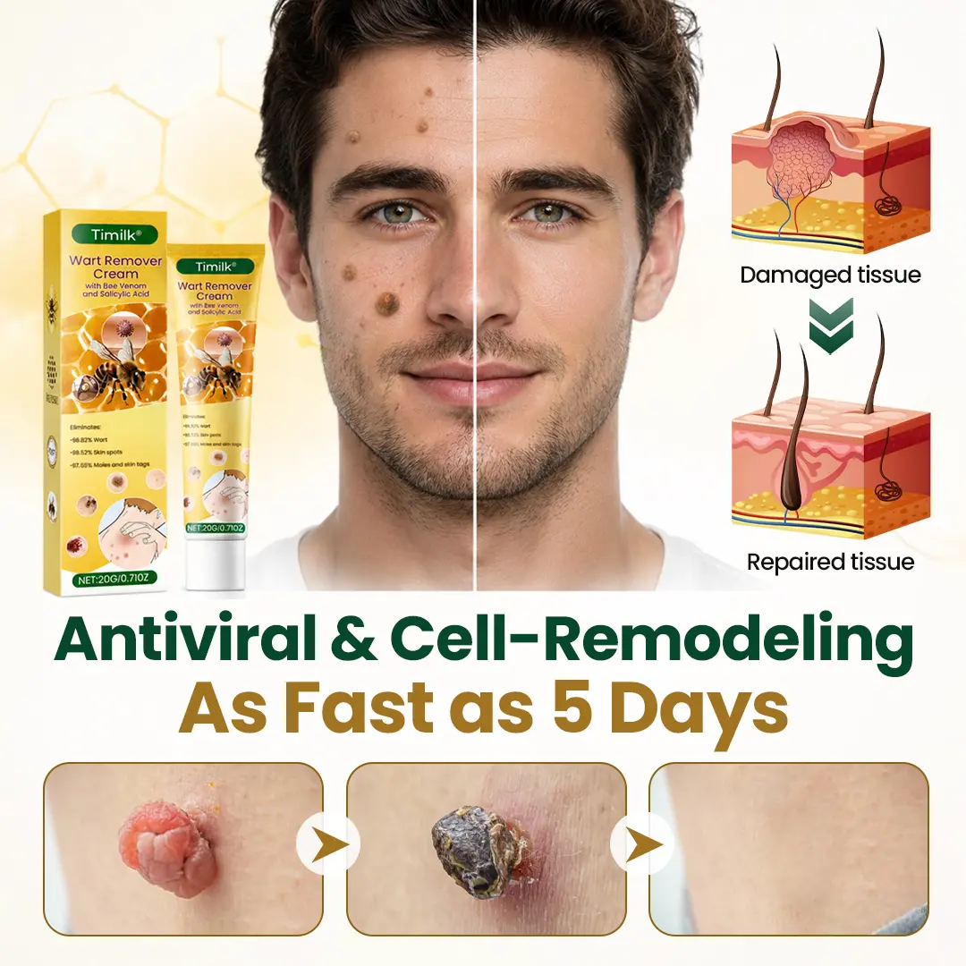 Timilk® Wart Remover Cream