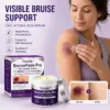 Timilk® BruiseFade Pro Skin Repair Cream