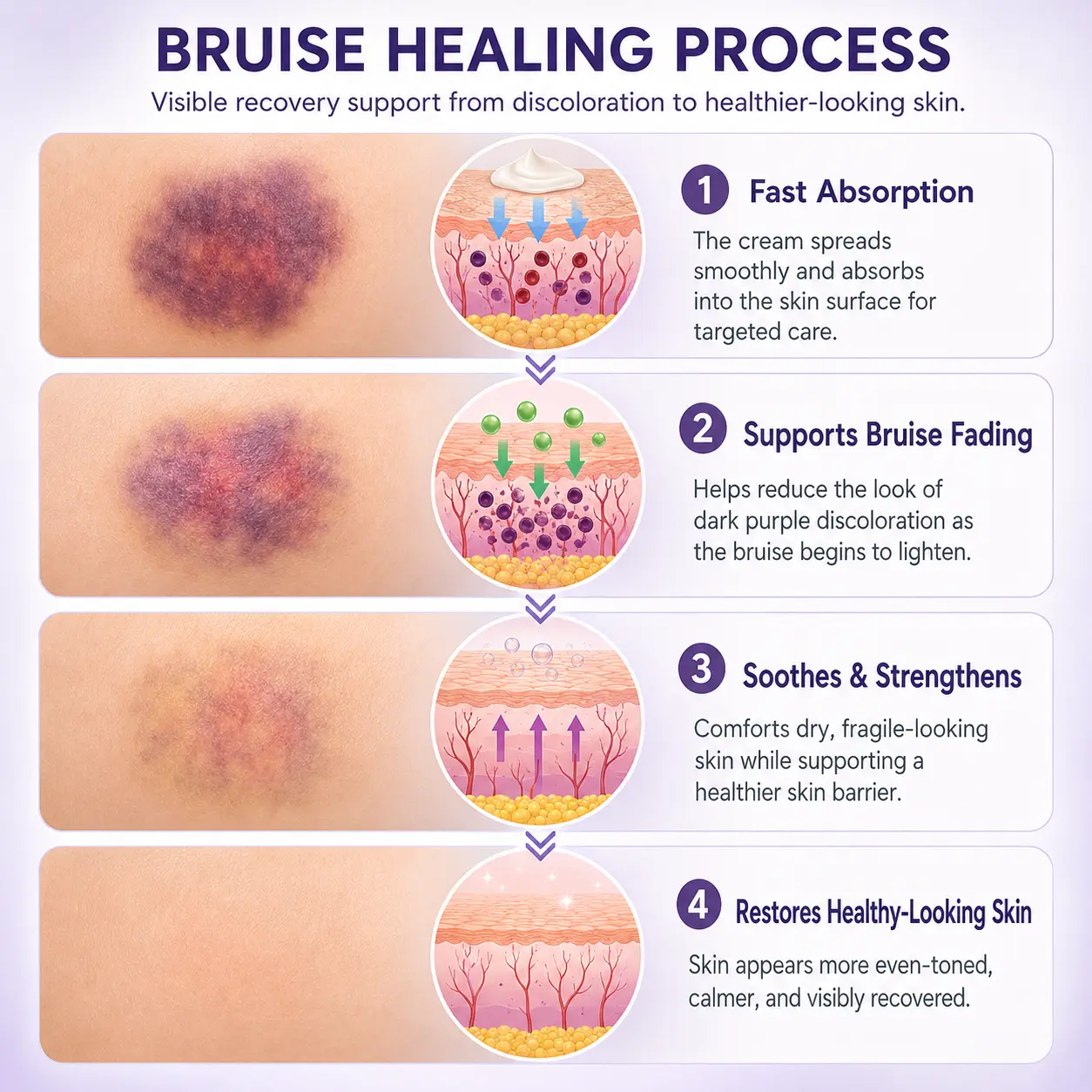 Timilk® BruiseFade Pro Skin Repair Cream