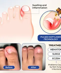 Timilk® FungiBee Advanced Nail Repair Solution