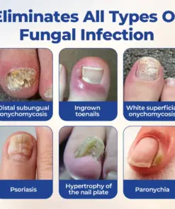 Timilk® FungiBee Advanced Nail Repair Solution