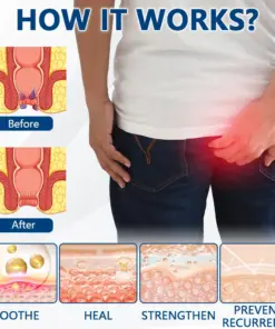 Timilk® HemoRelief Herbal Spray