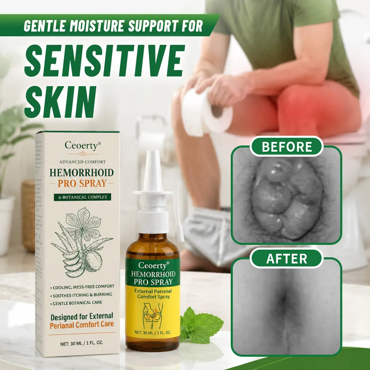 Timilk® ProctoEase Hemorrhoid Gel