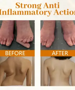 Timilk® ScorpiTakt Joint & Muscle Relief Ointment